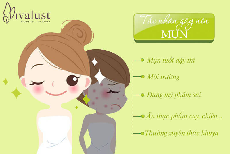Các tác nhân gây nên mụn ở tuổi dậy thì