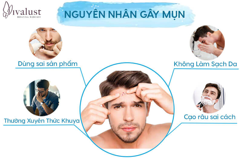 Nguyên nhân gây nên mụn ở nam giới