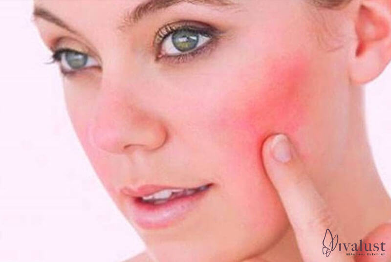 Làn da nhạy cảm cần sử dụng nước tẩy trang dịu nhẹ