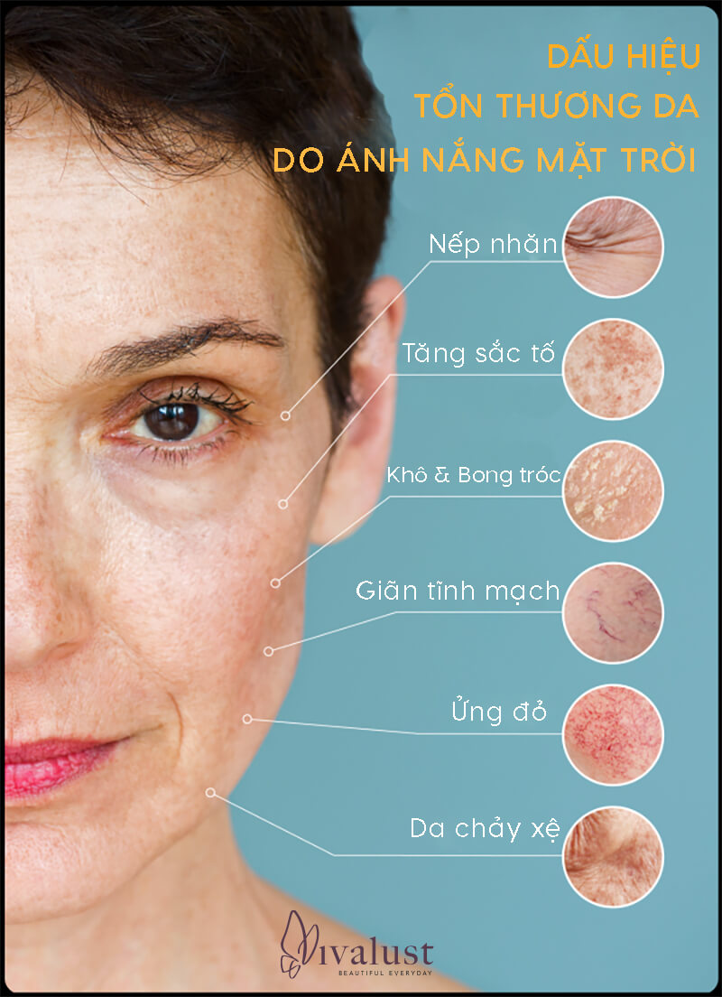 Những tác hại của ánh nắng mặt trời đối với làn da