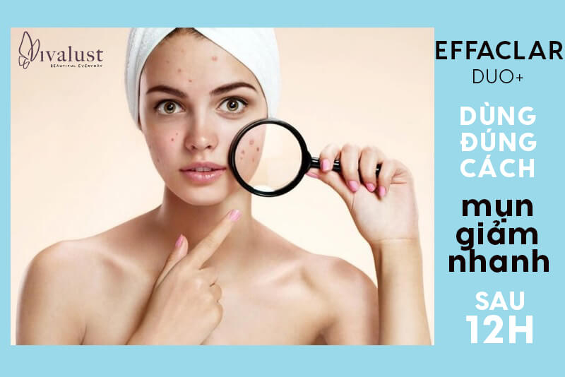Sử dụng kem trị mụn Effaclar Duo+ đúng cách