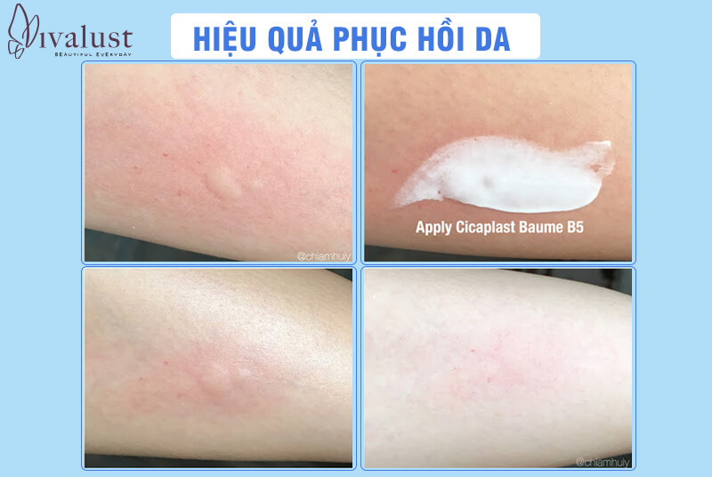 Hiệu quả làm dịu da đến từ La Roche Posay