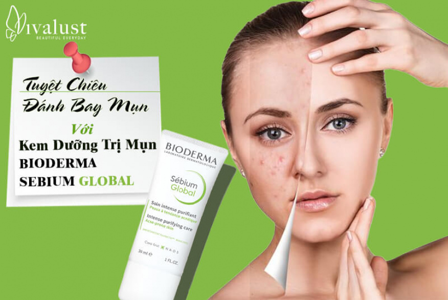 Bí quyết đánh bay mụn với kem dưỡng trị mụn Bioderma Sebium Global